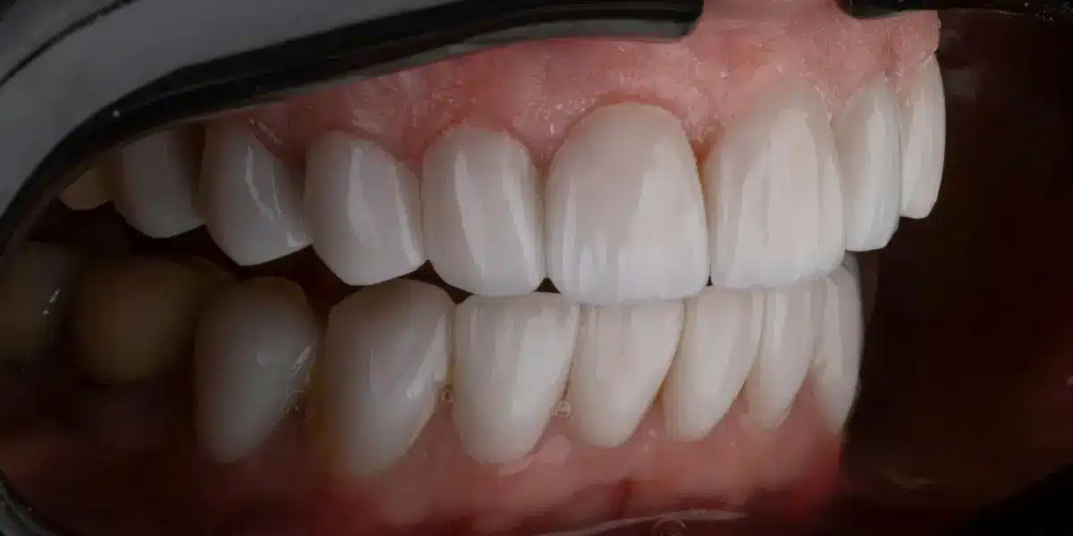 Can You Be a Dental Assistant in Texas Without a Degree?